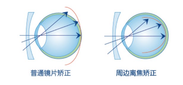 图片.png 图片.png