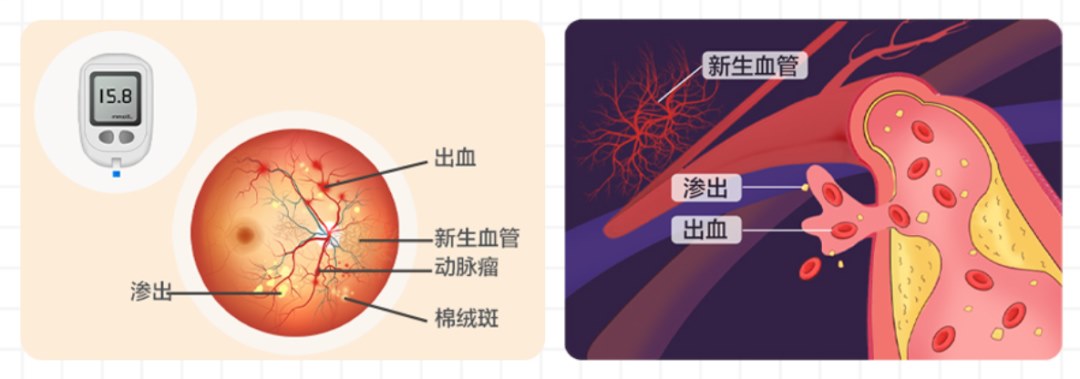 图片.png 图片.png