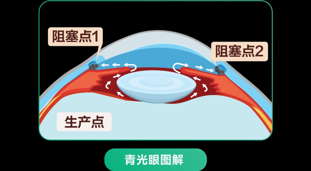 图片.png 图片.png