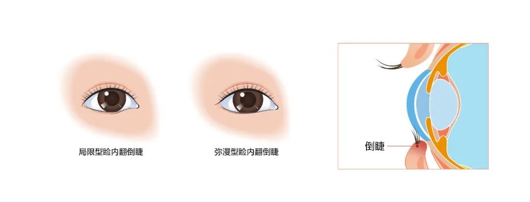 图片.png 图片.png