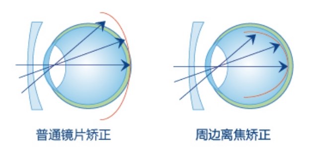 图片.png 图片.png