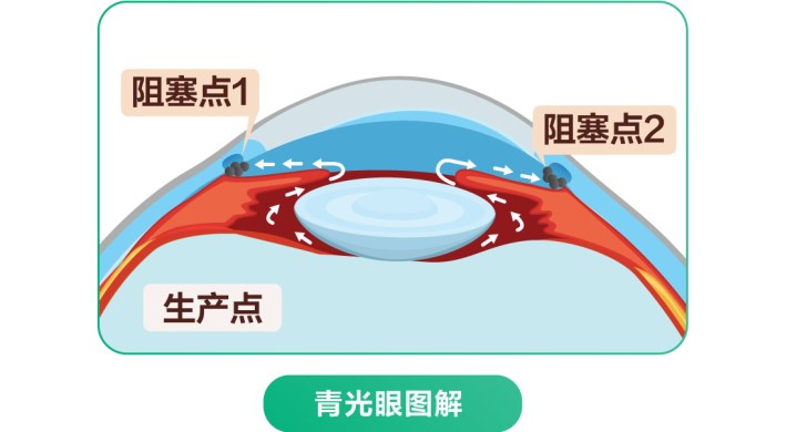 图片.png 图片.png