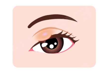 图片.png 图片.png