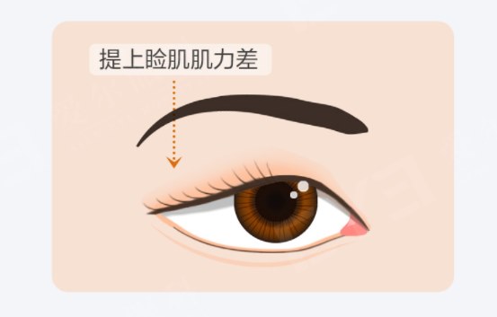 图片.png 图片.png