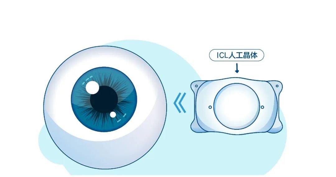 图片.png 图片.png