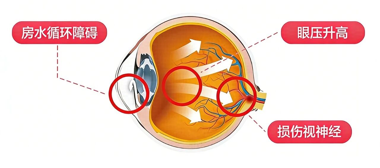 178331ed35e7fdd20dcf72a7e48e5ecb.jpg 178331ed35e7fdd20dcf72a7e48e5ecb.jpg